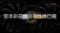 安本彩花确诊恶性淋巴瘤 安本彩花身体怎么样了