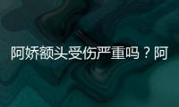 阿娇额头受伤严重吗？阿娇晒受伤额头照透露将痊愈